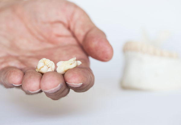 hand holding extracted teeth